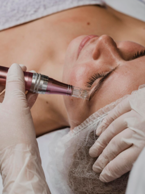 Dermapen Microneedling